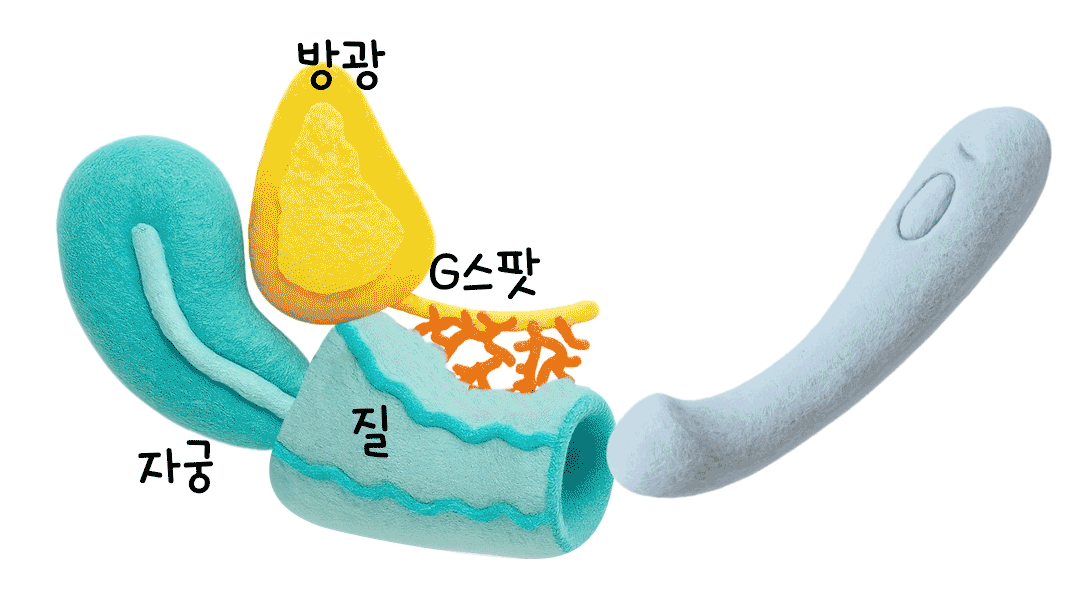 데임 아크 삽입
